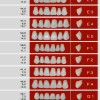 Eray Anterior Teeth